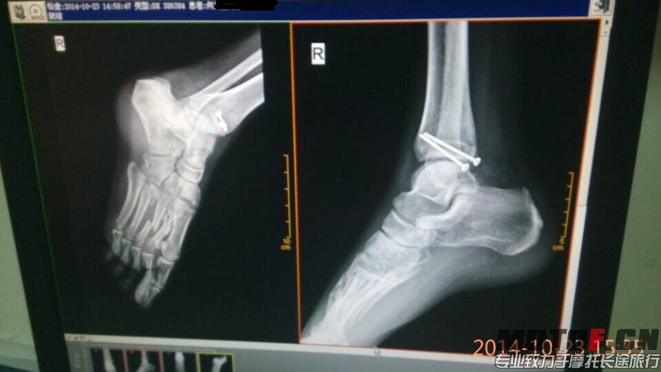 QQ图片20141108122512.jpg